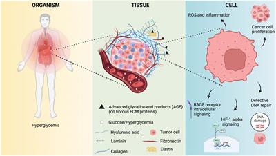 Diabetes and Cancer: A Twisted Bond